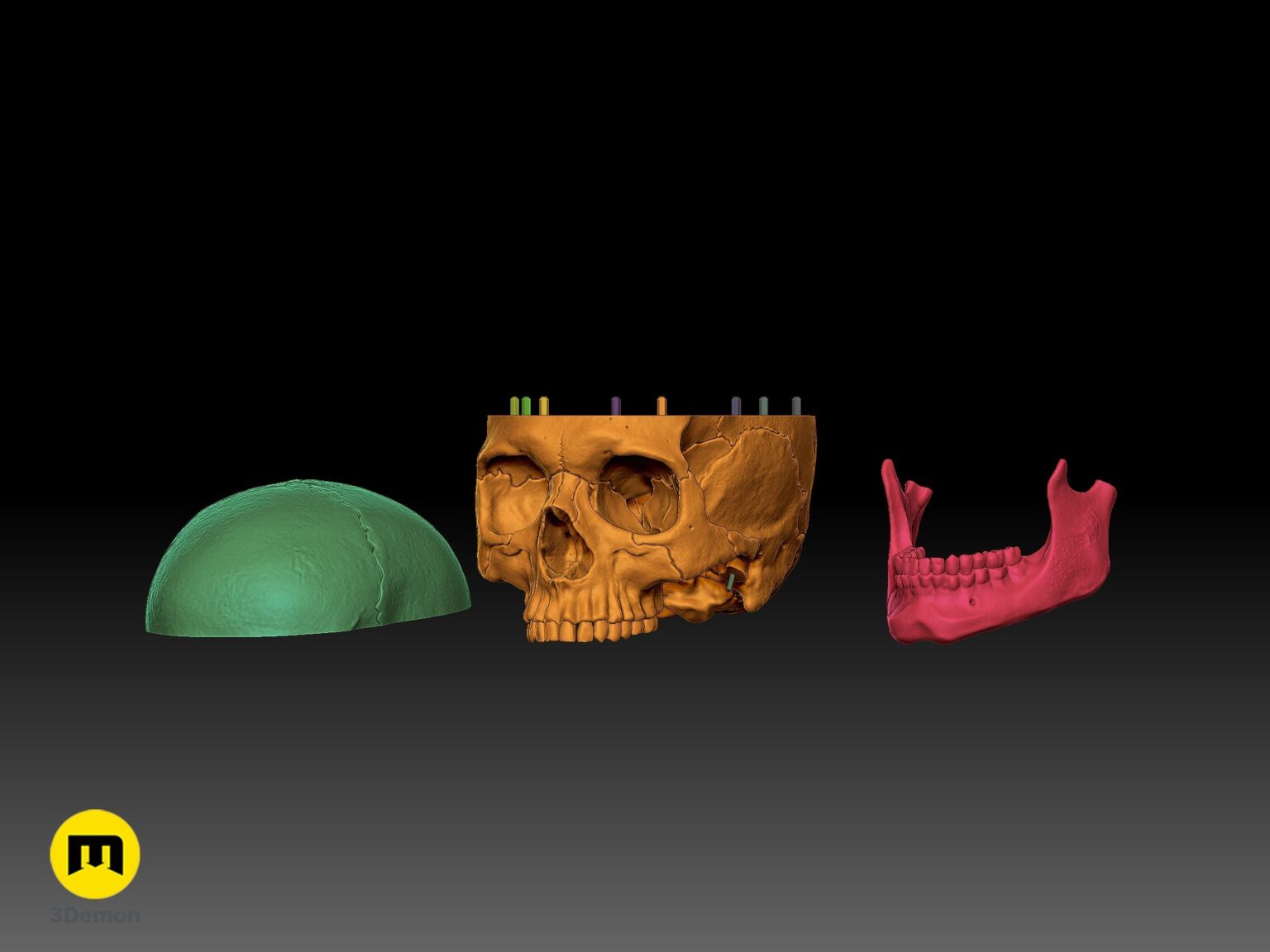 Side exploded view of the human skull 3D model components and assembly pins for easy 3D printing.